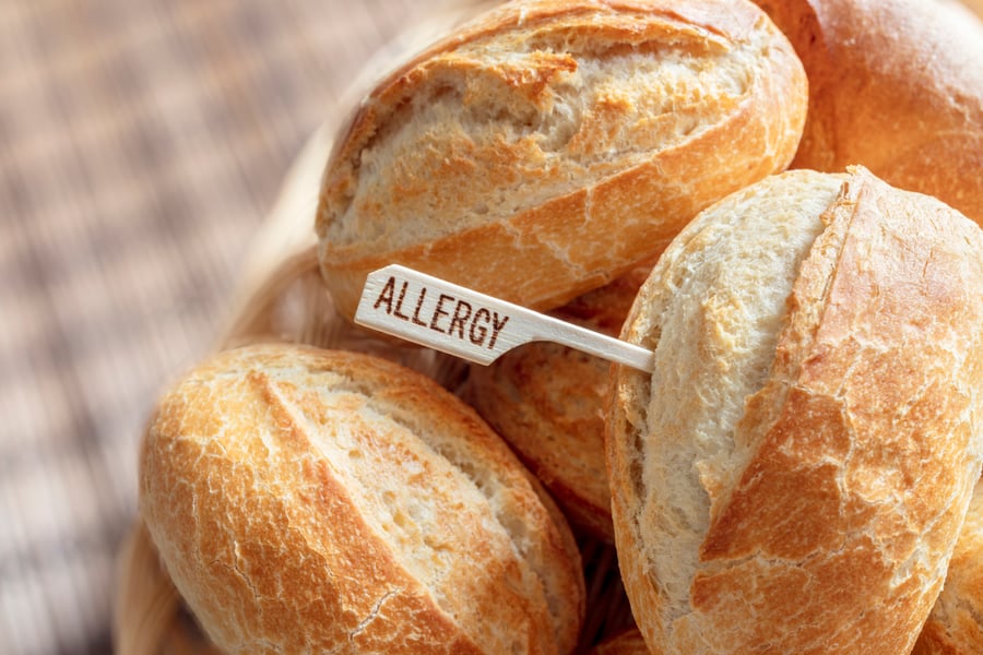 Allergy sign on white bread rolls, gluten intolerance and diet