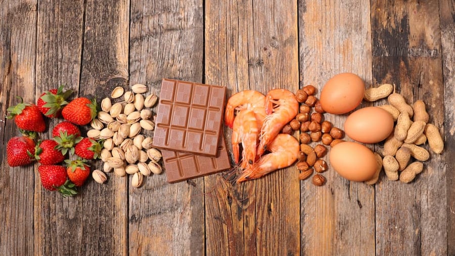 food allergen examples food allergen examples